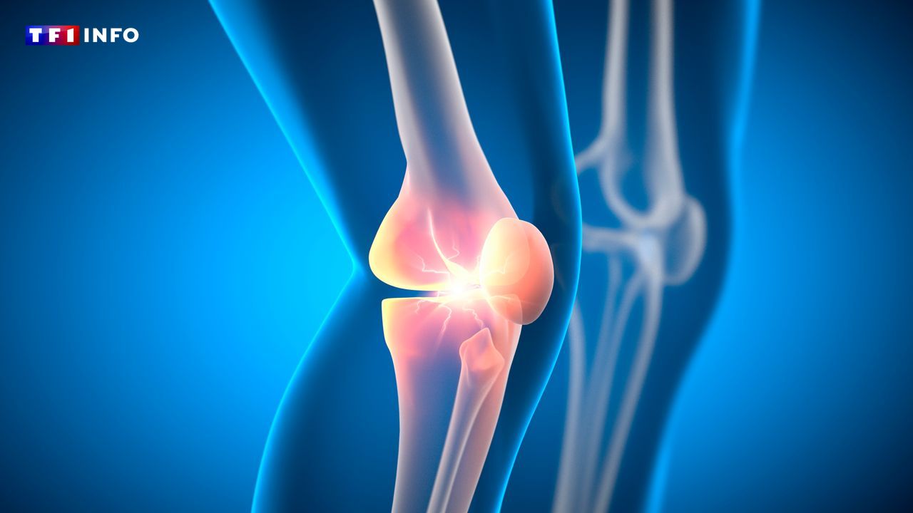 The Best Simple Exercises a Sports Medicine Doctor Swears By for Rock-Solid, Pain-Free Knees